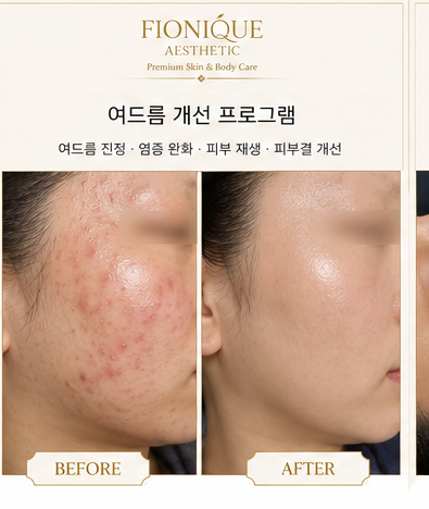 아크닛 컨트롤 시스템 케어 Before and After 2