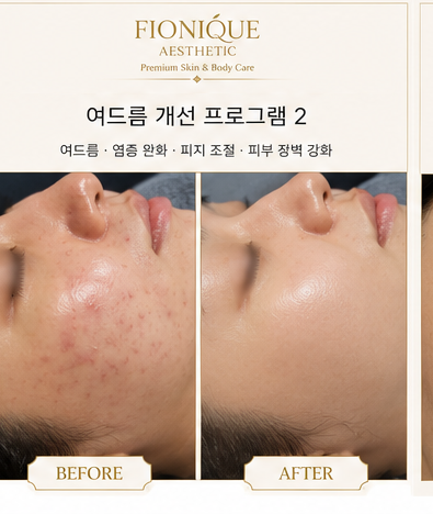 아크닛 컨트롤 시스템 케어 Before and After 1